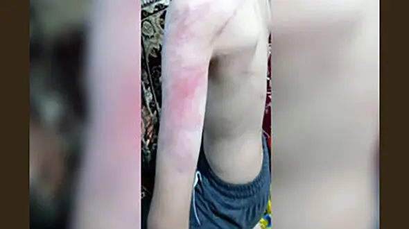 احضار متهم ضرب و جرح دانش‌آموزان ‌سنندجی به دادسرا‌ 