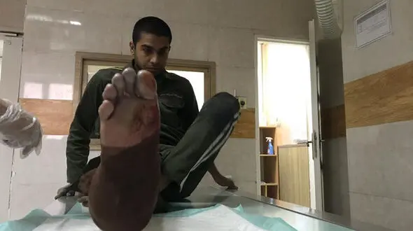 اولین مصدوم پلیس تهران در چهارشنبه سوری / با نارنجک به او حمله کردند + فیلم و عکس
