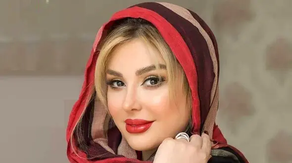 تغییر چهره زیاد نیوشا ضیغمی /  زاویه صورت و دماغ زیبا ! + عکس
