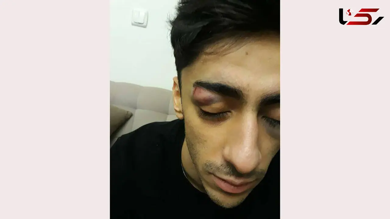 ضرب و شتم ملی‌پوش ژیمناستیک ایران توسط افراد ناشناس + عکس 
