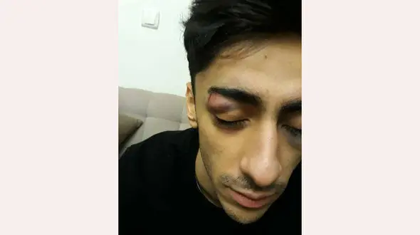 ضرب و شتم ملی‌پوش ژیمناستیک ایران توسط افراد ناشناس + عکس 
