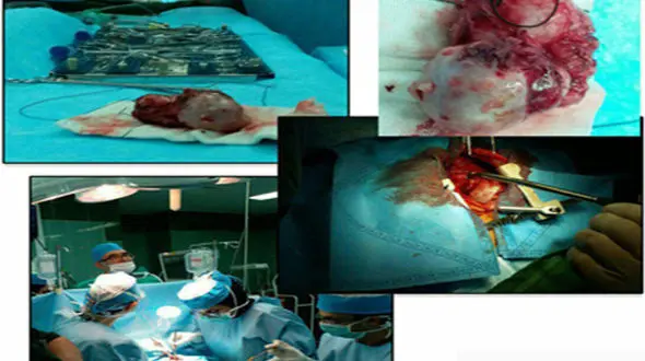 نجات جان نوزاد 3 ماهه پس از 2 بار سکته قلبی در زاهدان + عکس