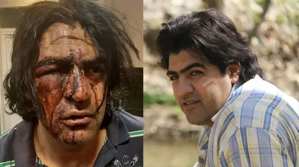 زورگیران بی رحم راننده اسنپ کرمانشاهی را چاقو چاقو کردند + فیلم و عکس تکاندهنده