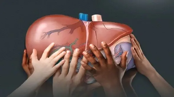 درمان کبد چرب با نسخه های طبیعی