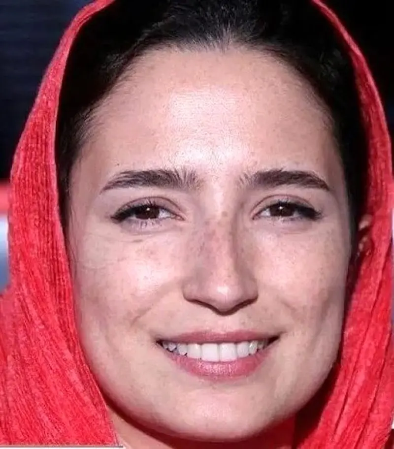 بازگشت به طبیعتِ چهره و زیبایی اصیل