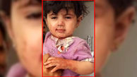 جنجال عکس یک دختر بچه  یتیم در جهان! / همه خانواده مردند و او در یمن زنده ماند +عکس