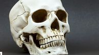 Human Skull on Mantelpiece Identified as Man Missing For 8 Years