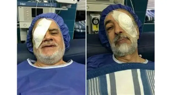 جراحی چشم بزرگان چپ و راست کشور / چپ وراست تار می بینند !