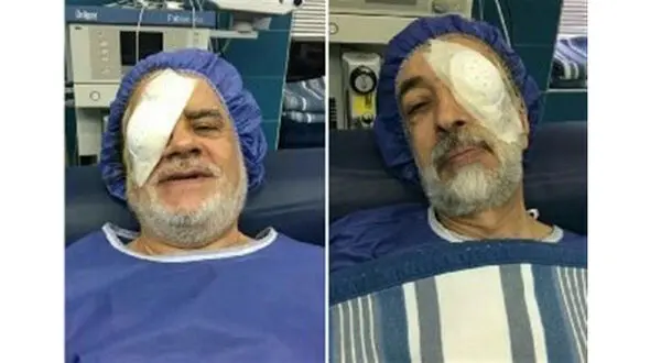 جراحی چشم بزرگان چپ و راست کشور / چپ وراست تار می بینند !