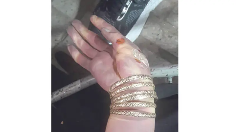 دست مقتول