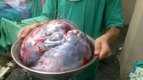 زنده ماندن زن 60 ساله بعد از عمل جراحی سخت+عکس