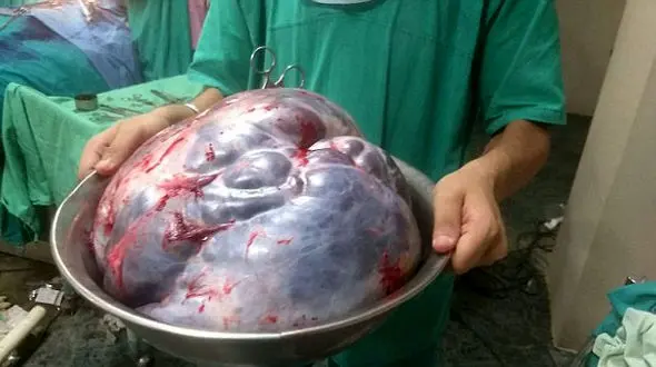 زنده ماندن زن 60 ساله بعد از عمل جراحی سخت+عکس