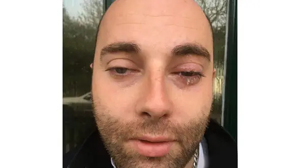 وحشتناک ترین اشتباه زندگی یک مرد + عکس