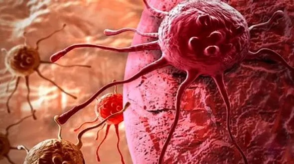 رشد سرطان در سایه کرونا / 40 درصد فوتی های کرونا به بیماری های غیرواگیر مبتلا بودند