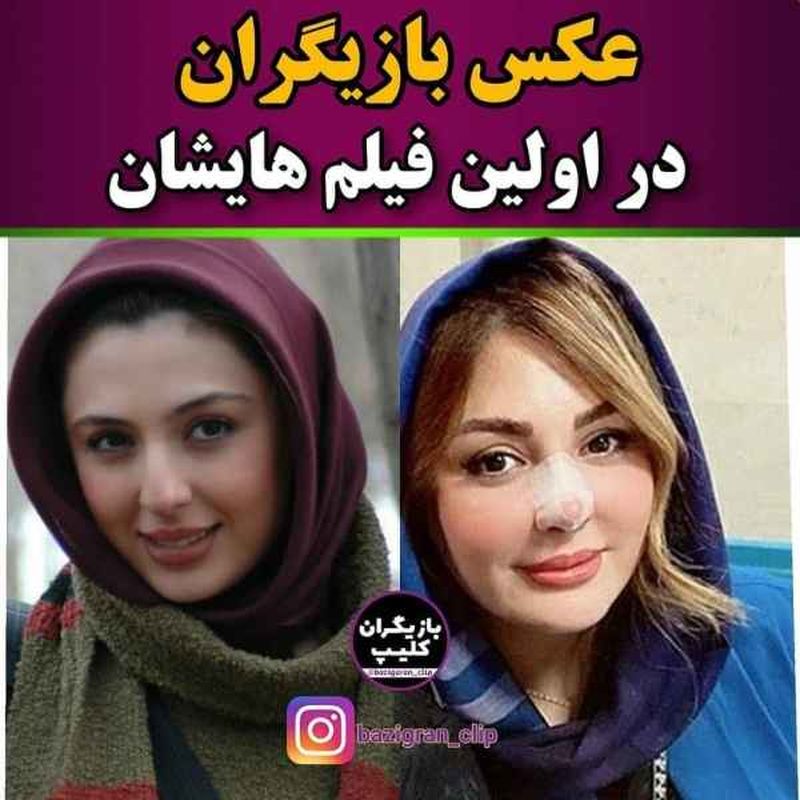 عکس های قدیمی بازیگران مشهور ایرانی بدون عمل زیبایی