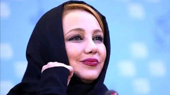 بهنوش بختیاری از این رو به اون رو شده است / خانم بازیگر چرا هروز عمل زیبایی می کند؟!