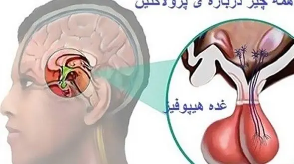 ترشح بیش از اندازه این غده با حوصله درمان می شود