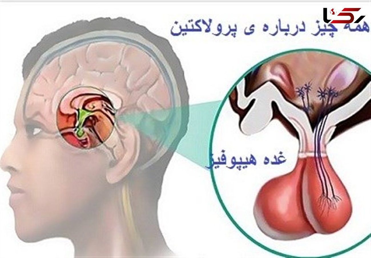 ترشح بیش از اندازه این غده با حوصله درمان می شود