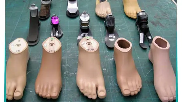 افزایش هزینه دست و پای مصنوعی با تحت بیمه پوشش قرار نگرفتن ارتز و پروتز 