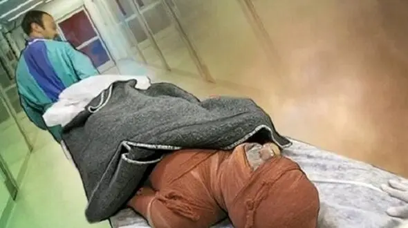قتل آتشین دختر تهرانی در خانه دوست پسرش / سگ خانگی مان باعث این اتفاق بود شکم خودمم سوخته !