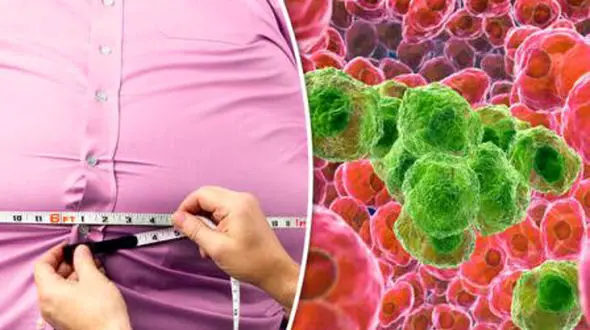 پدیده شکم گلدانی چیست؟