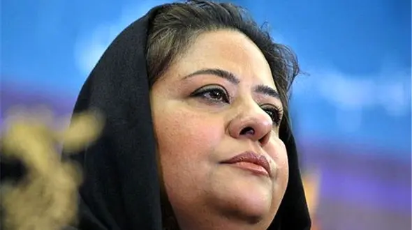 رابعه اسکویی با این تغییر چهره صددرصدی روی بهنوش طباطبایی را کم کرد