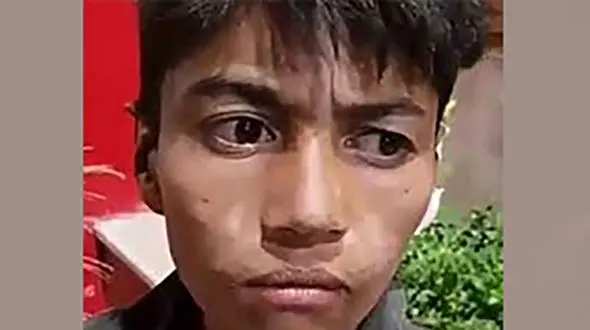 «گوش نبریده» کودک جنجالی فضای مجازی دوباره خبرساز شد! + عکس
