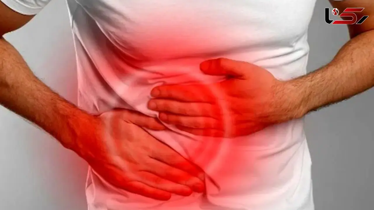 سرطان آپاندیس چیست؟ هرآنچه درباره این بیماری نادر باید بدانید