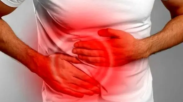 سرطان آپاندیس چیست؟ هرآنچه درباره این بیماری نادر باید بدانید