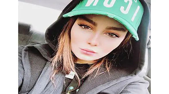 این خانم بازیگران گونه کاشته اند! + عکس  صورت های مصنوعی اما زیبا !