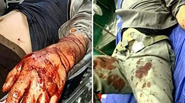 تصویر پیکر خونین 2 محیط بان صومعه سرایی+ عکس
