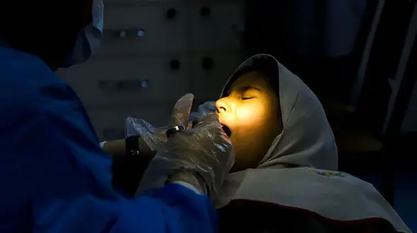 فیشورسیلنت چیست و چطور از پوسیدگی دندان کودکان جلوگیری می کند؟