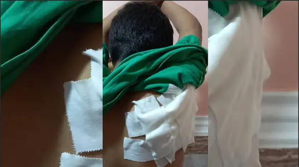حمله خونین سگ به پسربچه 8 ساله در آبادان + جزییات تلخ