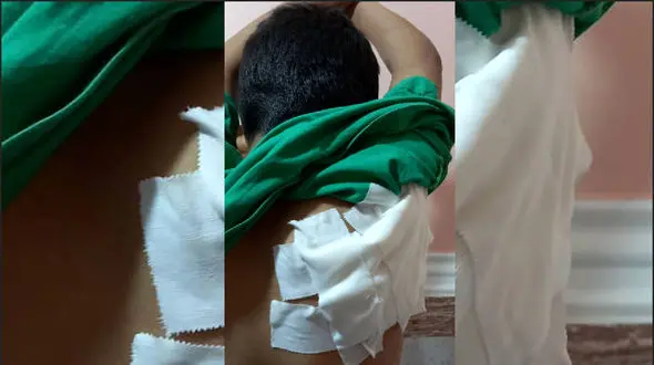 حمله خونین سگ به پسربچه 8 ساله در آبادان + جزییات تلخ