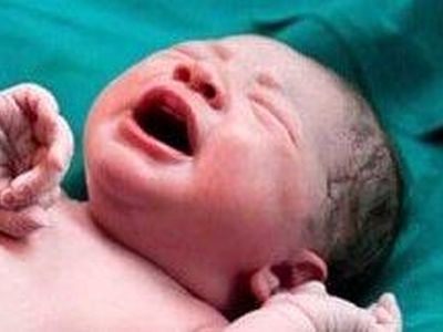 زنده شدن جنین فریز شده پس از 12 سال در اصفهان