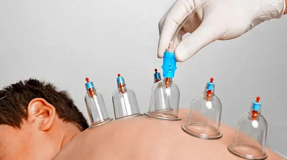 درمان دردهای عضلانی با حجامت 