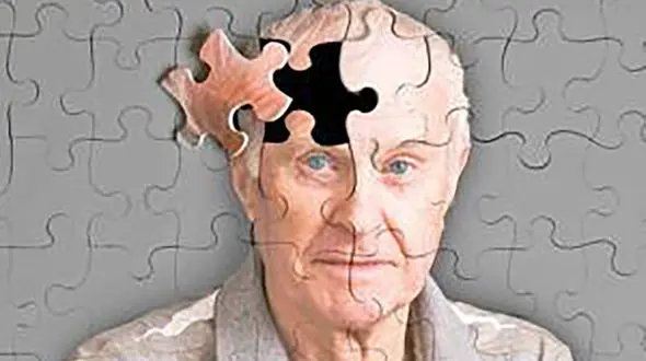 پنیر و خامه پرچرب دشمن زوال عقل