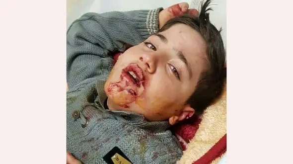 سگ ها پسر بچه تبریزی را لت و پار کردند + عکس های دلخراش