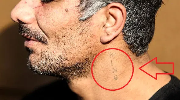 خالکوبی عجیب دزد پلید در پایتخت/ این مرد لقبش را روی گردنش حک کرده است؟ 