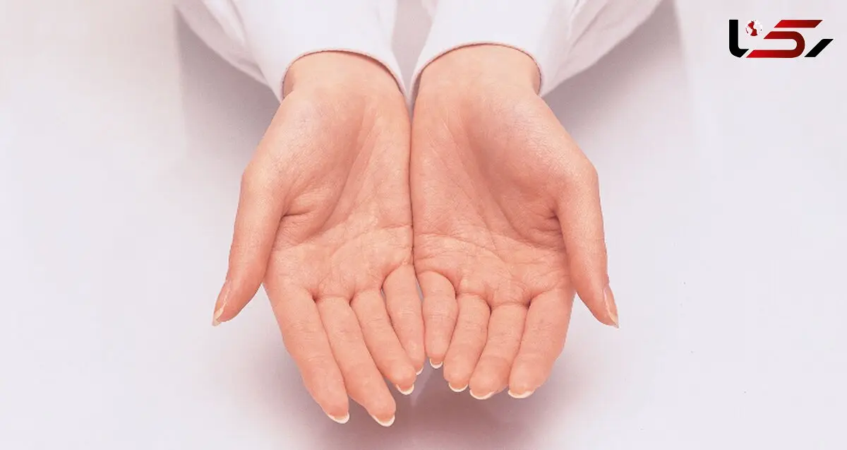 نقش بوتاکس در کاهش عرق کف دست