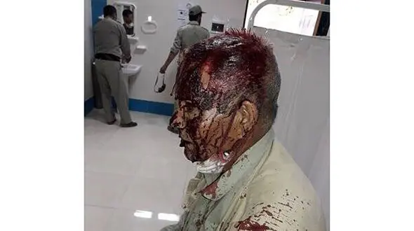 عکس فجیع از پیکر خونین محیط بان در حمله شکارچیان 