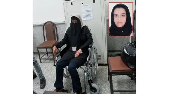 این دختر دانشجو در حسادت زنانه چهره اش را از دست داد/ 62 عمل جراحی برای یافتن چهره گمشده ام انجام گرفته است + عکس فاطمه قبل و بعد حادثه شوم