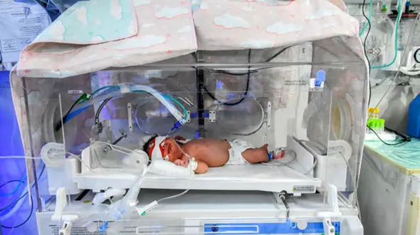 تولد نوزادی با 51 هزار ویروس کرونا