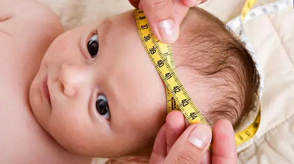 هیدروسفالی چیست؟ / جدول های مرتبط و مهم