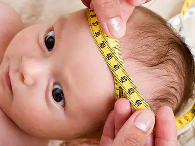 هیدروسفالی چیست؟ / جدول های مرتبط و مهم