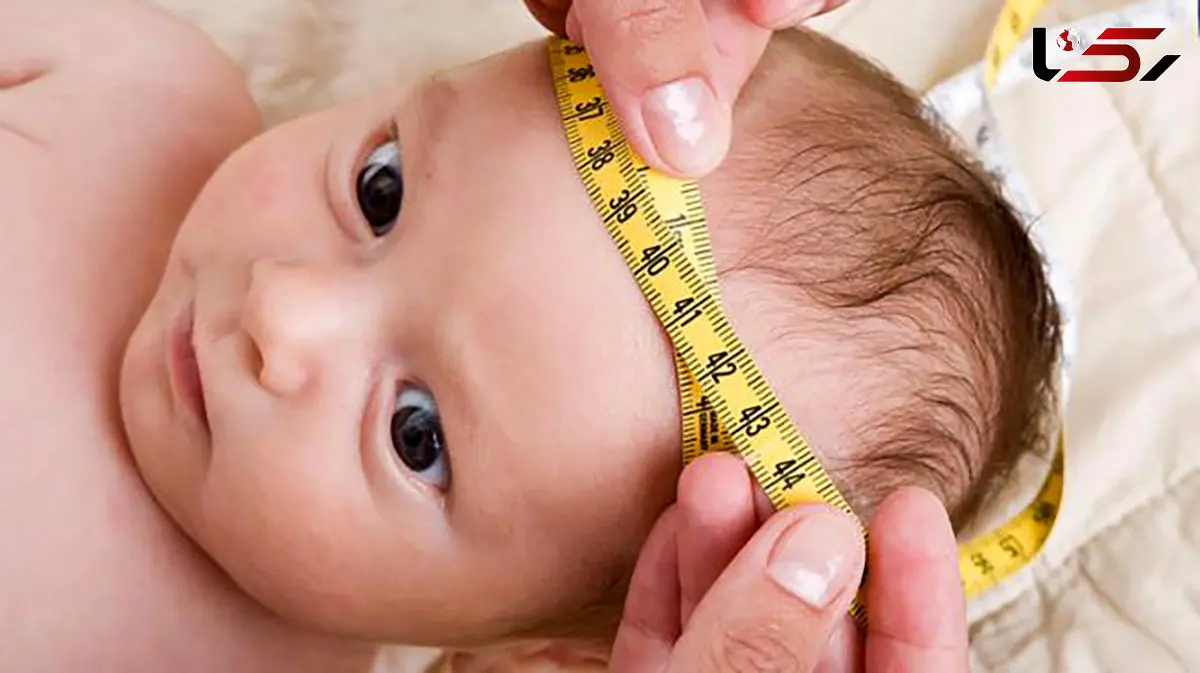 هیدروسفالی چیست؟ / جدول های مرتبط و مهم