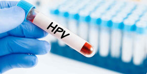 واکسن HPV ایرانی وارد بازار شد