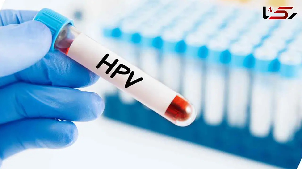 واکسن HPV ایرانی وارد بازار شد