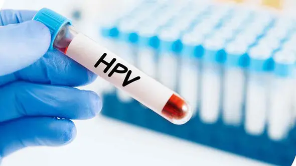 واکسن HPV ایرانی وارد بازار شد