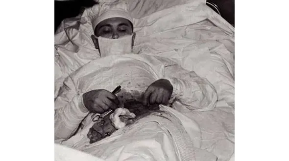 پزشکی که آپاندیس خود را جراحی کرد+عکس